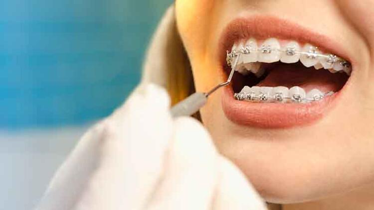 Dişlerin yerinin tel ile düzenlenmesi diş köklerine zarar verebilir