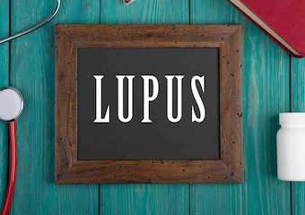 Lupus hastalığı