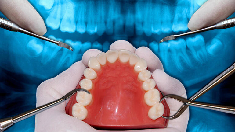 Maskeli yaşam ortodontik tedavileri nasıl etkiledi